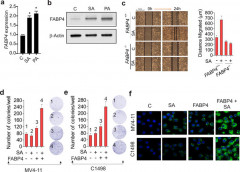 Targeting epigenetic pathway with gold nanoparticles for acute myeloid leukemia therapy